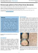 Cover page: Dermoscopic patterns of terra firma-forme dermatosis
