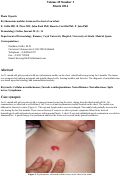 Cover page: Erythematous nodular lesion on the chest of an infant