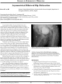 Cover page: Asymmetrical Bilateral Hip Dislocation