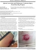 Cover page: Splenic Laceration and Pulmonary Contusion Injury From Bean Bag Weapon