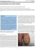 Cover page: Acquired blue nevus of the nail bed