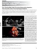Cover page: Free Floating Right Atrial Thrombus Removed by Aspiration Thrombectomy Under Transesophageal Guidance.