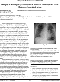 Cover page: Images in Emergency Medicine: Chemical Pneumonitis from Hydrocarbon Aspiration