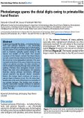 Cover page: Photodamage spares the distal digits owing to primate-like hand flexion