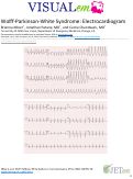 Cover page: Wolff-Parkinson-White Syndrome: Electrocardiogram