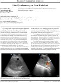 Cover page: Iliac Pseudoaneurysm from Endoleak
