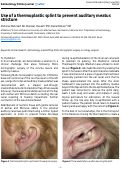 Cover page: Use of a thermoplastic splint to prevent auditory meatus stricture