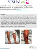Cover page: A Case Report of Acute Compartment Syndrome