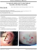 Cover page: Levamisole-adulterated Cocaine Induced Vasculitis with Skin Ulcerations