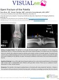 Cover page: Open Fracture of the Patella