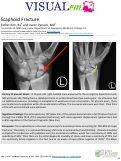 Cover page: Scaphoid Fracture