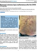 Cover page: New-onset cutaneous lupus erythematosus after the COVID-19 vaccine