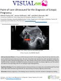 Cover page: Point-of-care Ultrasound for the Diagnosis of Ectopic Pregnancy