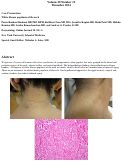 Cover page: White fibrous papulosis of the neck