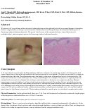 Cover page: Fluoroscopy-associated radiation dermatitis