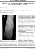 Cover page: Charcot Foot? Charcot Arthropathy Caused by Lisfranc Fracture-Dislocation in a Diabetic