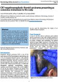 Cover page: CK7 negative anaplastic thyroid carcinoma presenting as cutaneous metastases to the scalp