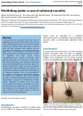 Cover page: Hitchhiking spider: a case of unilateral vasculitis