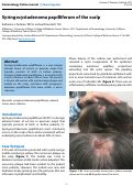 Cover page: Syringocystadenoma papilliferum of the scalp