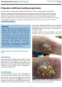 Cover page: A leg ulcer with hard, yellow projections