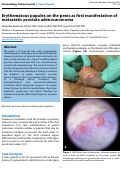 Cover page: Erythematous papules on the penis as first manifestation of metastatic prostate adenocarcinoma