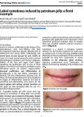 Cover page: Labial comedones induced by petroleum jelly: a florid example