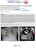 Cover page: Traumatic Diaphragmatic Rupture – A Case Report