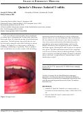 Cover page: Quincke’s Disease: Isolated Uvulitis