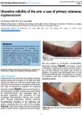 Cover page: Ulcerative cellulitis of the arm: a case of primary cutaneous cryptococcosis