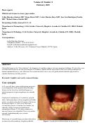 Cover page: Whitish oral lesions in a heavy pipe smoker