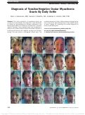 Cover page: Diagnosis of Tensilon-Negative Ocular Myasthenia Gravis By Daily Selfie