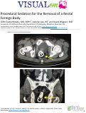 Cover page: Procedural Sedation for the Removal of a Rectal Foreign Body