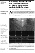Cover page: Coronary sinus pacing for the management of right ventricular and atrial infarction with isolated right ventricular pulsus alternans.