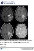Cover page: Supratentorial primitive neuroectodermal tumor in an adult: a case report and review of the literature