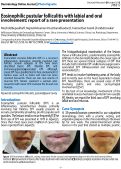 Cover page: Eosinophilic pustular folliculitis with labial and oral involvement: report of a rare presentation