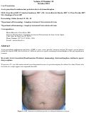 Cover page: Acute generalized exanthematous pustulosis due to dextromethorphan