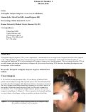 Cover page: Triangular temporal alopecia: a rare case in adulthood