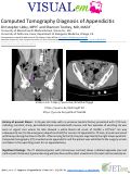 Cover page: CT Diagnosis of Appendicitis