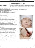 Cover page: Traumatic Facial Nerve Palsy
