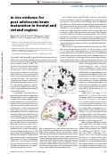 Cover page: In vivo evidence for post-adolescent brain maturation in frontal and striatal regions