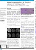 Cover page: Unusual high-grade and low-grade glioma in an infant with PPP1CB-ALK gene fusion