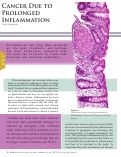 Cover page: Cancer Due to Prolonged Inflammation